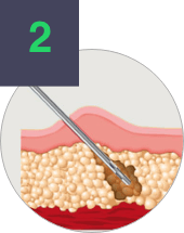 Stem Cell Therapy components