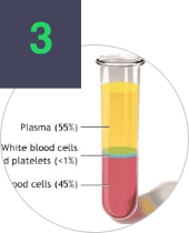 Stem Cell Treatment