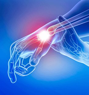 Wrist Pain Stem Cell treatment