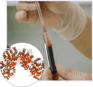 Alpha-2-Macroglobulin (A2M) Injections