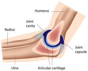 joint replacement treatment