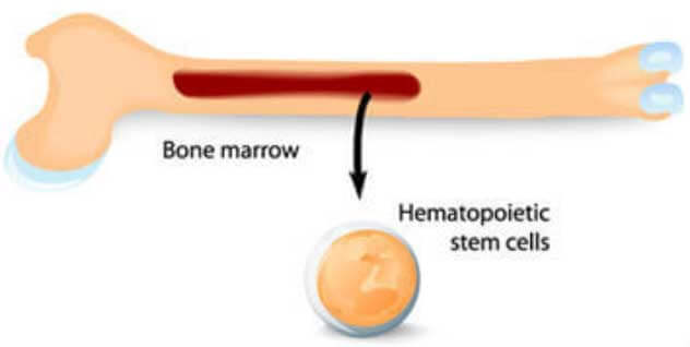 Bone Marrow Stem Cell Treatment