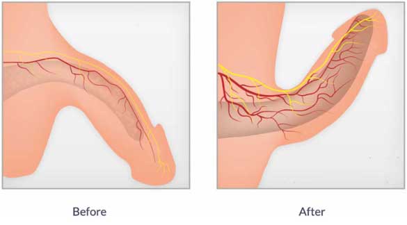 Complete Examine On The Perfect Treatments For Erectile Dysfunction