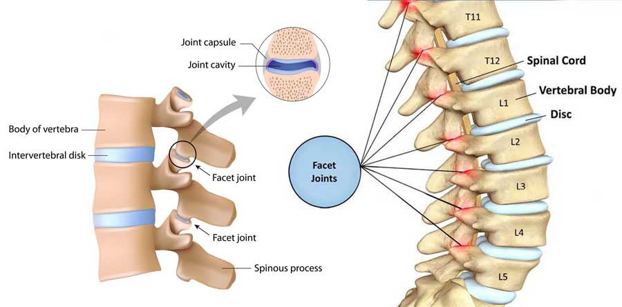 facet joint detail