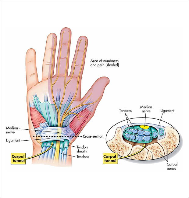 Hydrodissection